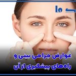 عوارض جراحی بینی و راه‌های پیشگیری از آن